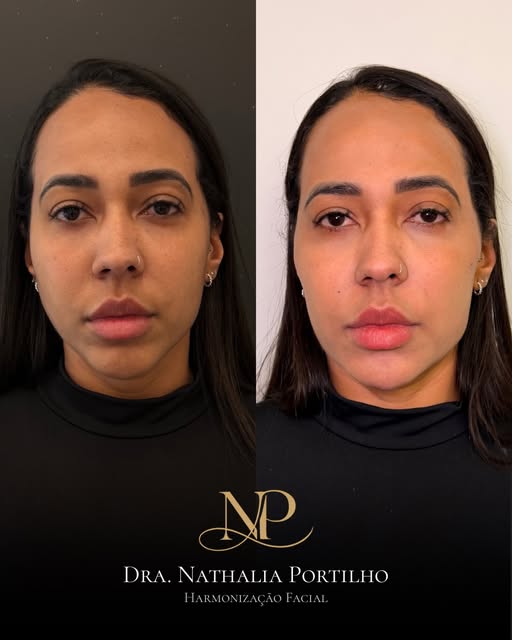 Antes e depois de um caso com planejamento individual publicado pela Nathália, apresentado lado a lado na composição original.